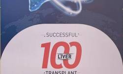 Successful-100-Liver-Transplant-Surgeries