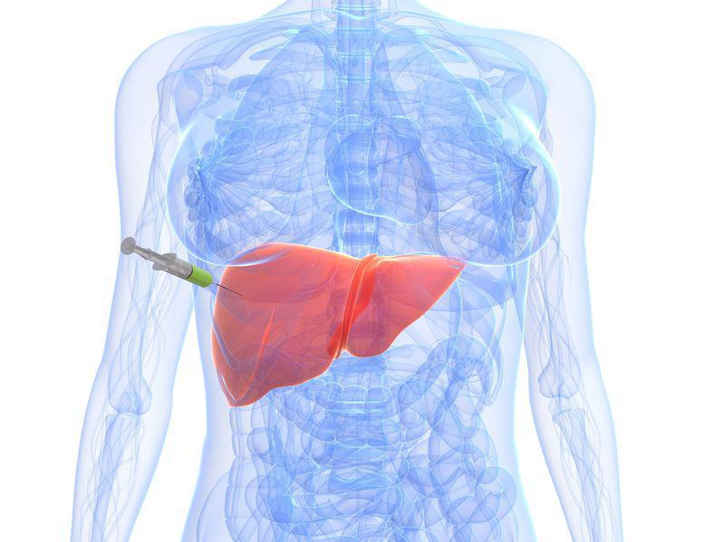 pin-on-liver-biopsy-procedure