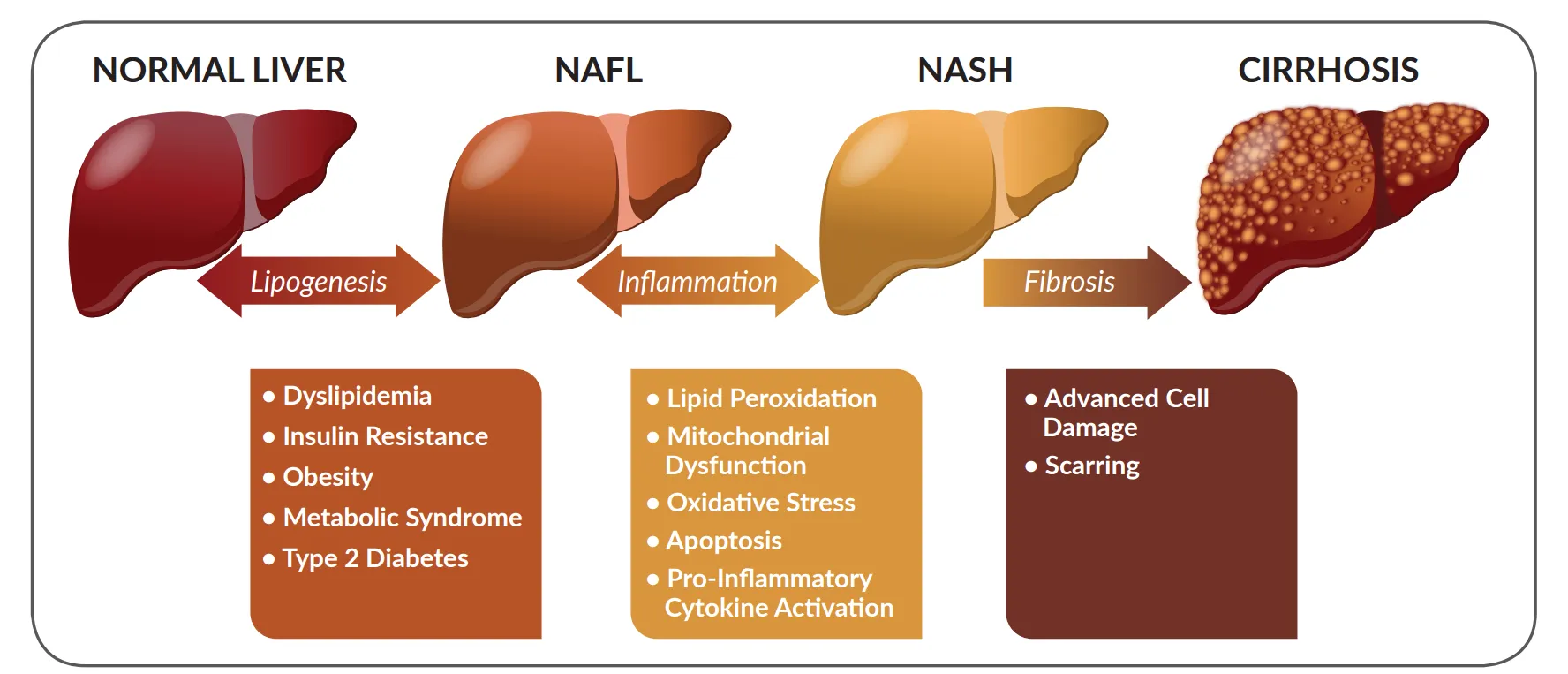 fatty liver and normal liver