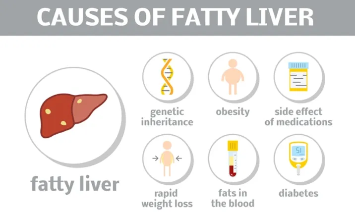 Causes of Fatty Liver
