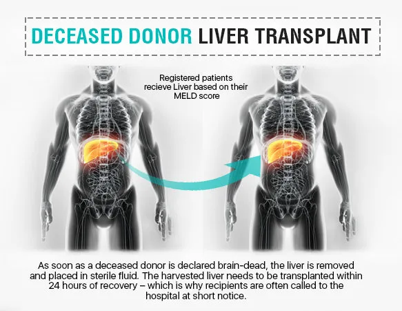 Liver Transplant Surgeon In Mumbai