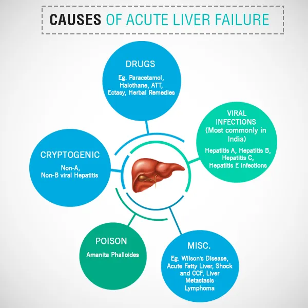 Causes of Acute Liver Failure 
