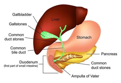 CBD Stones: Symptoms, Diagnosis and Treatment in Mumbai