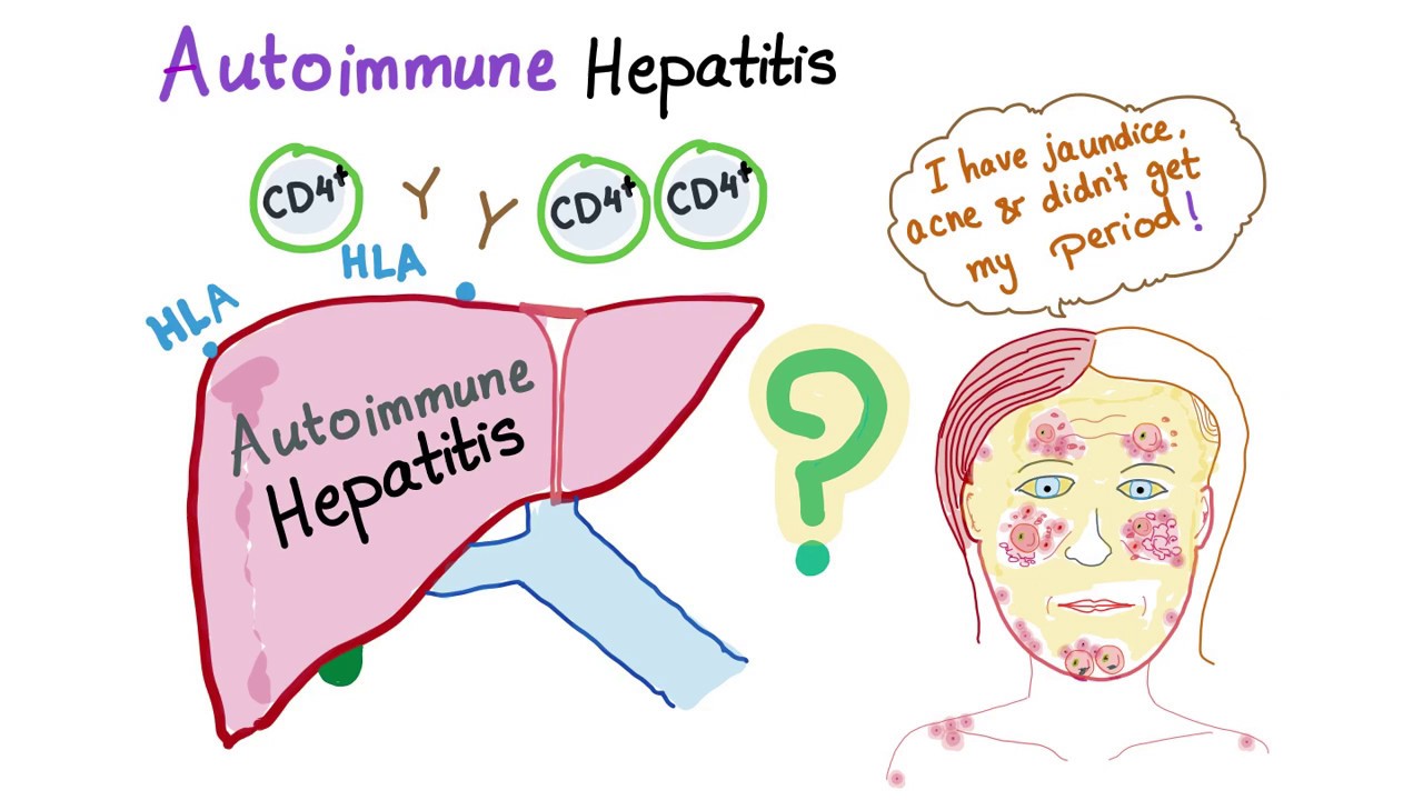 Autoimmune Hepatitis Treatment In Mumbai